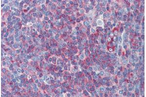 Human Tonsil: Formalin-Fixed, Paraffin-Embedded (FFPE)