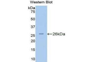 Western Blotting (WB) image for anti-Protein Kinase N2 (PKN2) (AA 282-487) antibody (ABIN1175312) (PKN2 anticorps  (AA 282-487))