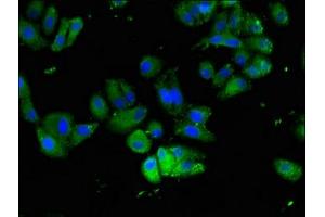 Immunofluorescent analysis of HepG2 cells using ABIN7165354 at dilution of 1:100 and Alexa Fluor 488-congugated AffiniPure Goat Anti-Rabbit IgG(H+L) (FAM111A anticorps  (AA 26-179))