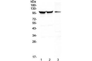Western blot testing of 1) rat brain, 2) mouse brain and 3) mouse NIH3T3 lysate with Dynamin 1 antibody at 0. (Dynamin 1 anticorps)