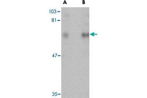 Western blot analysis of CPEB1 in rat brain tissue lysate with CPEB1 polyclonal antibody  at (A) 1 and (B) 2 ug/mL . (CPEB1 anticorps  (N-Term))