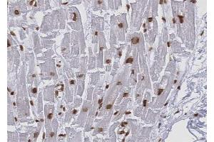 ABIN6268814 at 1/100 staining human Heart muscle tissue sections by IHC-P. (KEAP1 anticorps)