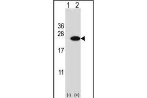 Western blot analysis of CIRBP (arrow) using rabbit polyclonal CIRBP Antibody (C-term) (ABIN653083 and ABIN2842680).