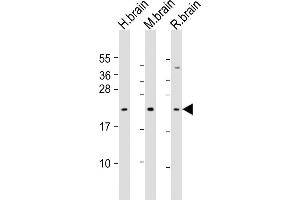 All lanes : Anti-FGF12 Antibody (Center) at 1:1000 dilution Lane 1: human brain lysate Lane 2: mouse brain lysate Lane 3: rat brain lysate Lysates/proteins at 20 μg per lane. (FGF12 anticorps  (AA 159-191))