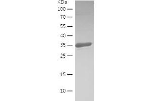 Western Blotting (WB) image for Ribonuclease T2 (RNASET2) (AA 172-256) protein (His-IF2DI Tag) (ABIN7124873)