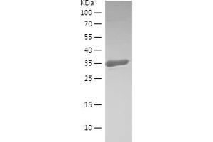Western Blotting (WB) image for Ribonuclease T2 (RNASET2) (AA 172-256) protein (His-IF2DI Tag) (ABIN7124873) (RNASET2 Protein (AA 172-256) (His-IF2DI Tag))