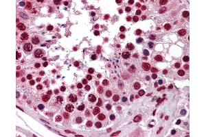 Anti-KHSRP antibody IHC of human testis.