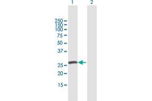 Western Blot analysis of SPC25 expression in transfected 293T cell line by SPC25 MaxPab polyclonal antibody. (SPC25 anticorps  (AA 1-224))