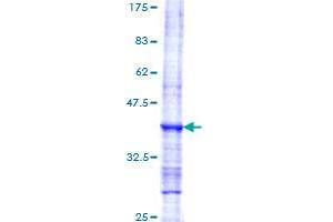 Myeloperoxidase Protein (MPO) (AA 646-745) (GST tag)