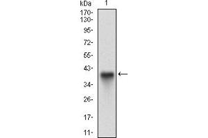 Fig. (CD15 anticorps  (AA 199-302))