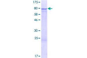 Image no. 1 for SMAD, Mothers Against DPP Homolog 5 (SMAD5) (AA 1-465) protein (GST tag) (ABIN1320609)