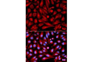 Immunofluorescence analysis of U2OS cell using MAP2K7 antibody. (MAP2K7 anticorps)