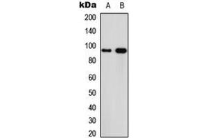 Western blot analysis of Calpain 3 expression in MCF7 (A), PC12 (B) whole cell lysates. (Calpain 3 anticorps  (Center))