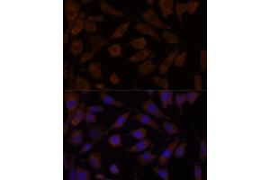 Immunofluorescence analysis of L929 cells using OXSR1 antibody (ABIN7269132) at dilution of 1:100.