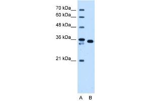 WB Suggested Anti-AKR1B1 Antibody Titration:  1. (AKR1B1 anticorps  (C-Term))