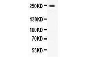 Western Blotting (WB) image for anti-Calcium Channel, Voltage-Dependent, L Type, alpha 1D Subunit (CACNA1D) (AA 2146-2161), (C-Term) antibody (ABIN3042544) (CACNA1D anticorps  (C-Term))