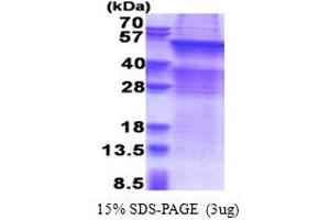 SDS-PAGE (SDS) image for UDP Glycosyltransferase 8 (UGT8) (AA 21-541) protein (His tag) (ABIN5853352)