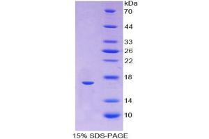 SDS-PAGE analysis of Human Hemoglobin alpha 1 Protein. (HBA1 Protéine)