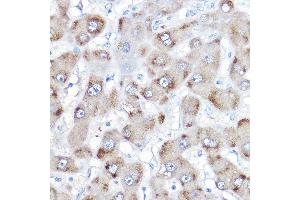 Immunohistochemistry of paraffin-embedded human liver using BAAT Rabbit pAb (ABIN6131367, ABIN6137411, ABIN6137412 and ABIN6223563) at dilution of 1:500 (40x lens). (BAAT anticorps  (AA 309-418))