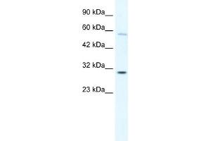 WB Suggested Anti-GATAD1 Antibody Titration: 0. (GATAD1 anticorps  (C-Term))