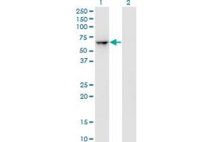 Western Blot analysis of ZNF350 expression in transfected 293T cell line by ZNF350 monoclonal antibody (M01), clone 1A9. (ZNF350 anticorps  (AA 1-532))