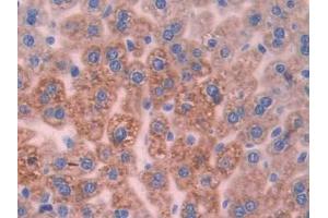 DAB staining on IHC-P; Samples: Mouse Liver Tissue