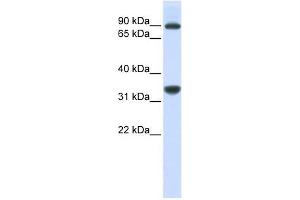 RRP1B antibody used at 1 ug/ml to detect target protein. (RRP1B anticorps)