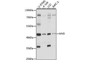 Western blot analysis of extracts of various cell lines, using MVD antibody (ABIN7268505) at 1:1000 dilution.