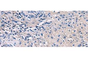 Immunohistochemistry of paraffin-embedded Human brain tissue using PROKR2 Polyclonal Antibody at dilution of 1:40(x200) (Prokineticin Receptor 2 anticorps)