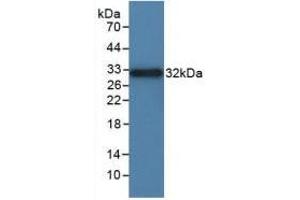 Western blot analysis of recombinant Rat ITGaD. (ITGAD anticorps  (AA 879-1099))