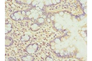 Immunohistochemistry of paraffin-embedded human small intestine tissue using ABIN7147935 at dilution of 1:100 (CLASP1 anticorps  (AA 1389-1538))