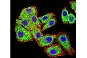 Immunofluorescence analysis of MCF-7 cells using PLD2 mouse mAb (green). (Phospholipase D2 anticorps  (AA 834-933))