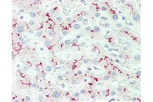 Anti-IL12RB2 antibody IHC staining of human liver.