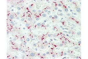 Anti-IL12RB2 antibody IHC staining of human liver. (IL12RB2 anticorps  (AA 756-783))