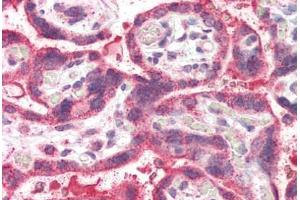 Human Placenta (formalin-fixed, paraffin-embedded) stained with NEIL1 antibody ABIN337008 at 5 ug/ml followed by biotinylated anti-goat IgG secondary antibody ABIN481715, alkaline phosphatase-streptavidin and chromogen. (NEIL1 anticorps  (AA 378-390))