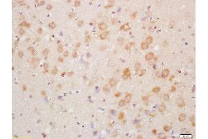 Formalin-fixed and paraffin embedded mouse brain labeled with Rabbit Anti-NDUFA8 Polyclonal Antibody, Unconjugated  at 1:200 followed by conjugation to the secondary antibody and DAB staining