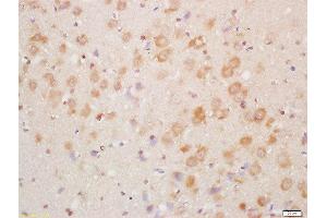 Formalin-fixed and paraffin embedded mouse brain labeled with Rabbit Anti-NDUFA8 Polyclonal Antibody, Unconjugated  at 1:200 followed by conjugation to the secondary antibody and DAB staining (NDUFA8 anticorps  (AA 101-172))