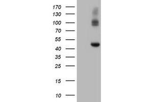 Image no. 5 for anti-Carboxypeptidase A2 (Pancreatic) (CPA2) antibody (ABIN1497596)