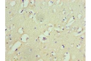Immunohistochemistry of paraffin-embedded human brain tissue using ABIN7153960 at dilution of 1:100 (Glutamate Receptor 1 anticorps  (AA 19-300))