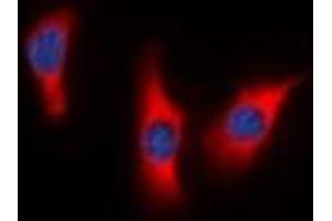 Immunofluorescent analysis of DUSP9 staining in HeLa cells.