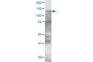 ERN1 monoclonal antibody (M05), clone 4E1 Western Blot analysis of ERN1 expression in HeLa . (ERN1 anticorps  (AA 401-500))