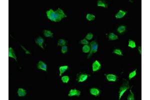 Immunofluorescent analysis of U251 cells using ABIN7149640 at dilution of 1:100 and Alexa Fluor 488-congugated AffiniPure Goat Anti-Rabbit IgG(H+L)