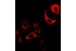 Immunofluorescent analysis of H-FABP staining in U2OS cells. (FABP3 anticorps)