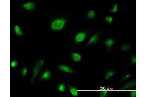 Immunofluorescence of monoclonal antibody to AK1 on HeLa cell. (Adenylate Kinase 1 anticorps  (AA 1-194))