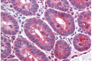 Mouse small intestine: Formalin-Fixed, Paraffin-Embedded (FFPE)