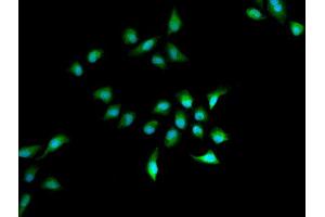 Immunofluorescence analysis of A549 cell using HELLS antibody. (HELLS anticorps)