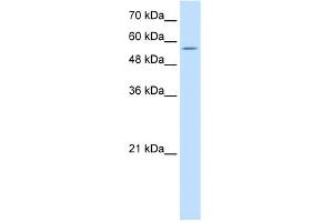 WB Suggested Anti-PDCD4 Antibody   Titration: 10 ug/ml   Positive Control: Jurkat Whole Cell (PDCD4 anticorps  (N-Term))