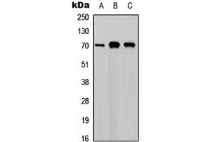 Western blot analysis of M-CSF expression in A549 (A), NS-1 (B), PC12 (C) whole cell lysates. (M-CSF/CSF1 anticorps  (C-Term))