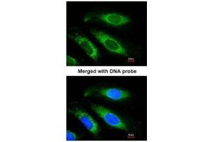 ICC/IF Image Immunofluorescence analysis of paraformaldehyde-fixed HeLa, using Beta-ETF, antibody at 1:200 dilution.