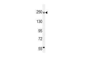 Western blot analysis in mouse bladder tissue lysates (35ug/lane).